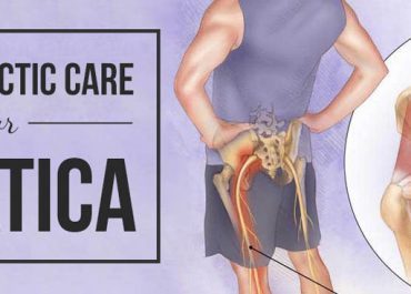 How to relieve sciatica nerve pain with chiropractic