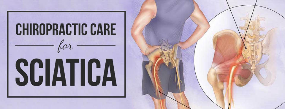 Sciatica Pain Relief - Take pressure off the sciatic nerve