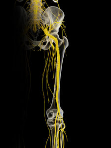 Sciatic nerve anatomy Plano TX chiropractic diagnosis sciatica compression points lumbar disc piriformis